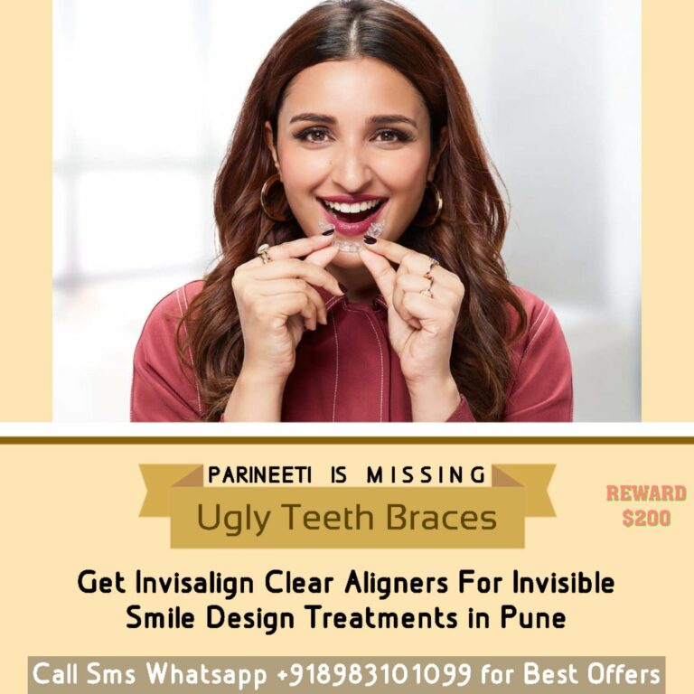 Best Dentist Dental Clinic in Pune: Dr. Mathesul Invisalign Orthodontist Braces & Dental Implant Clinic