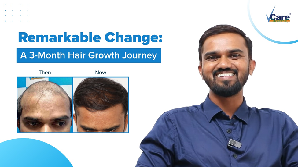 Unlock Your Confidence with VCare’s Revolutionary Hair Regrowth Solution!