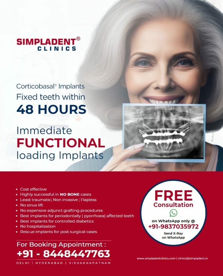 Discover the Power of Simpladent: A Network of Clinics Bringing World Class Dental Implant Within Reach