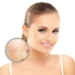 Truecaller Partners with HDFC ERGO to Launch Fraud Insurance