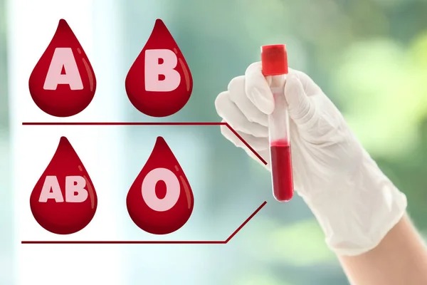 5 Reasons Why You Must Be Aware of Your Blood Group