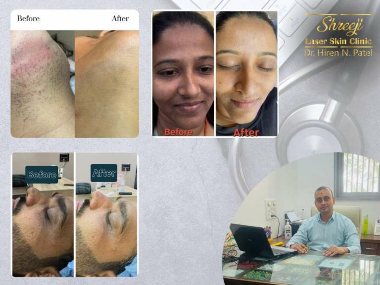 Discover Radiant Skin at Shreeji Laser Skin Clinic in Ahmedabad
