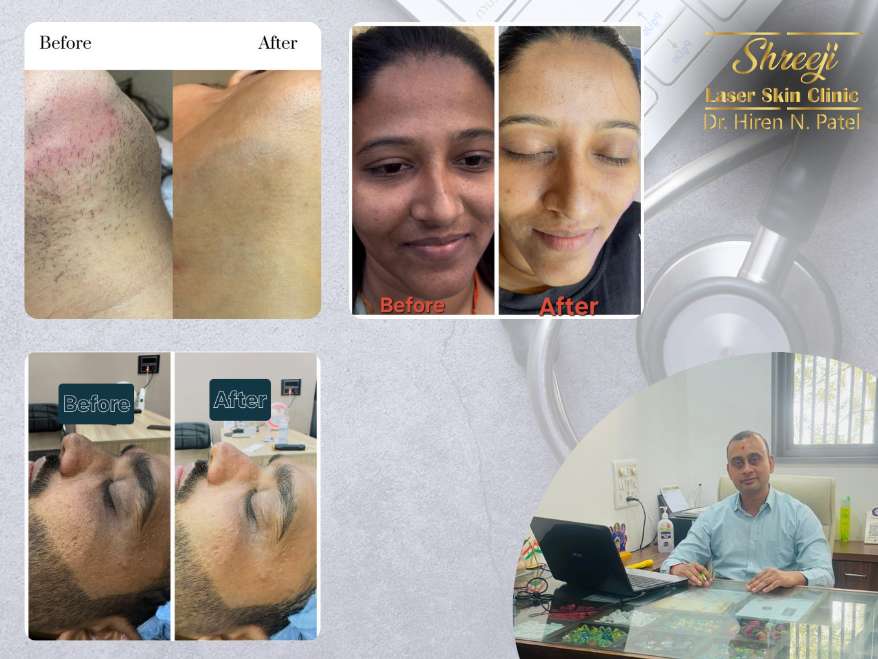 Discover Radiant Skin at Shreeji Laser Skin Clinic in Ahmedabad