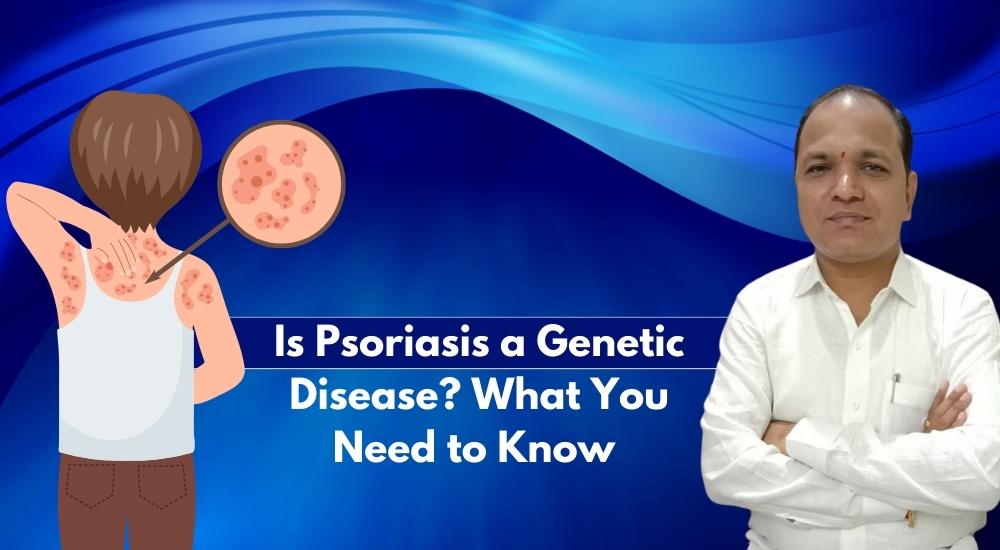 Is Psoriasis a Genetic Disease? What You Need to Know