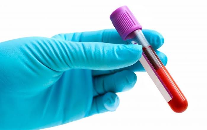How to Book a Blood Test in a Metro City?