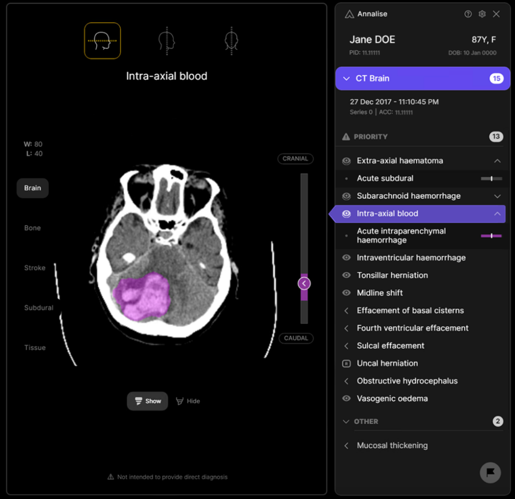 Aarthi Scans adopts Australian AI technology to elevate patient care management