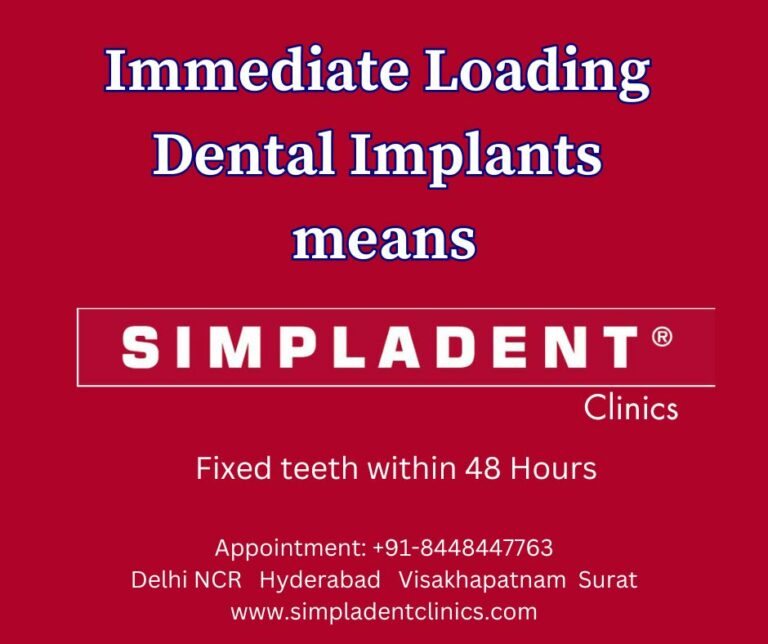 Why Choose Immediate Loading Dental Implants Over Traditional Implants?