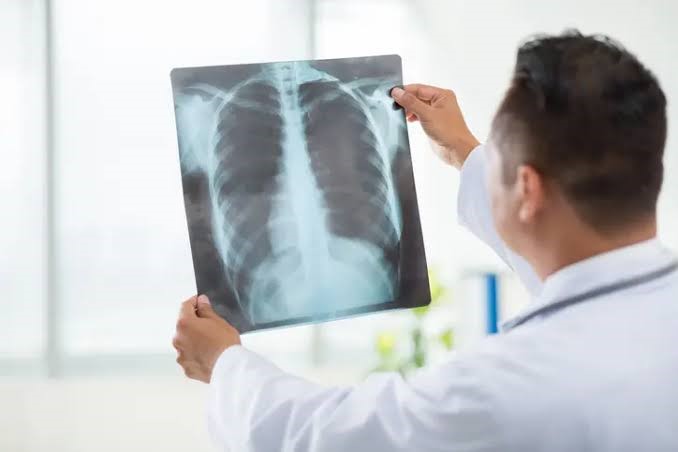 Signs You May Require an X-ray