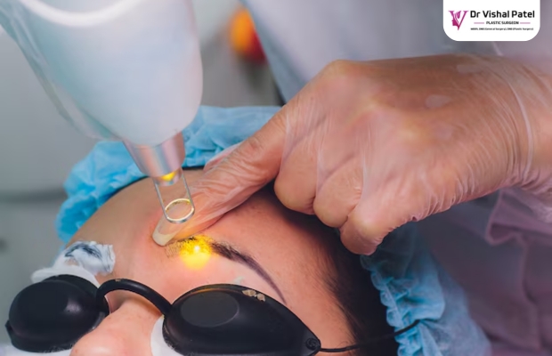 Blepharoplasty in Mumbai – Solution to Droopy Eyelids by Dr. Vishal Patel, Mumbai