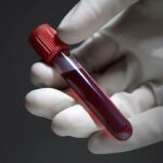 Kayakalp Global Emerges as India’s Leading Integrative Dermatology Centre for Vitiligo and Psoriasis Treatment