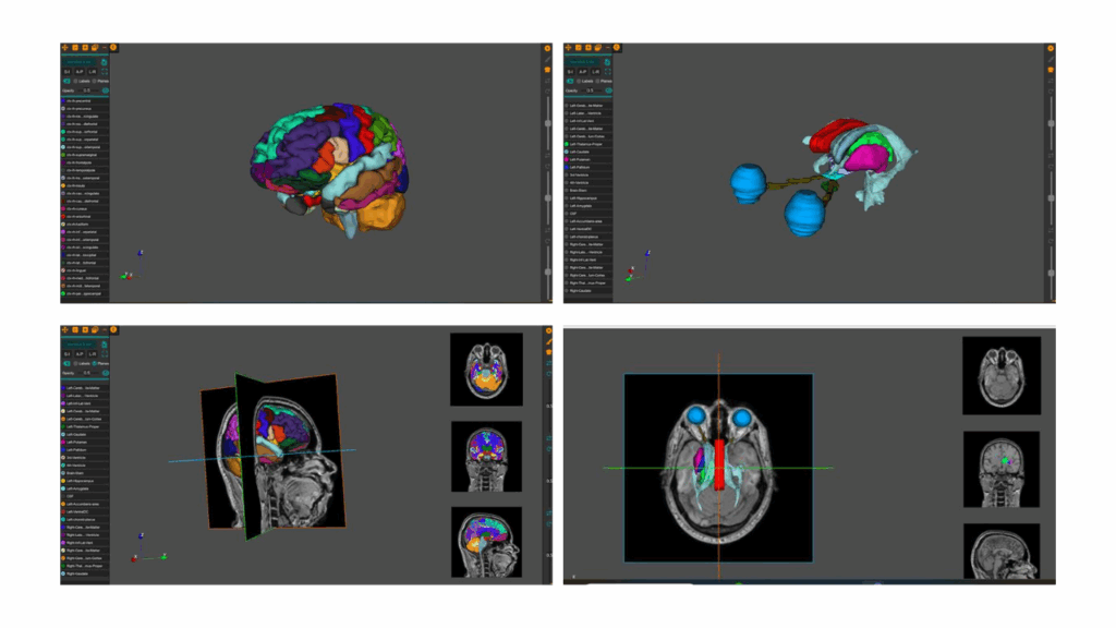 AnaVu: IIIT-Hyderabad’s 3D Anatomy Visualization Platform Transforming Medical Education