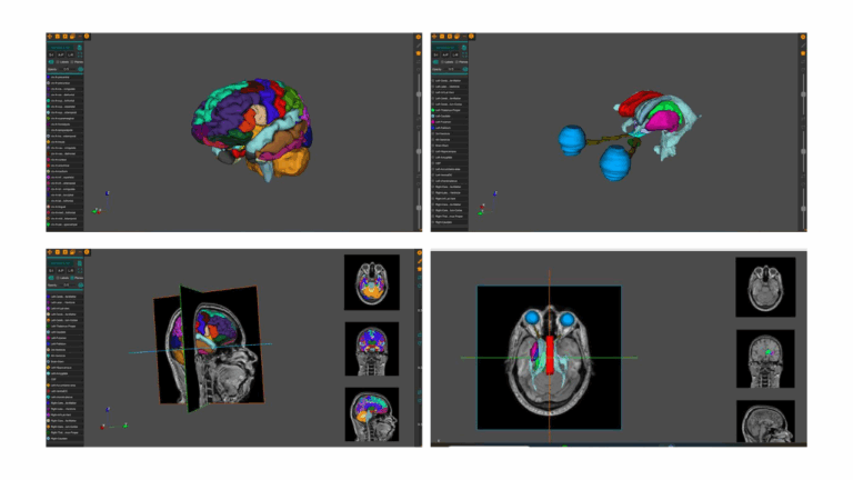 AnaVu: IIIT-Hyderabad’s 3D Anatomy Visualization Platform Transforming Medical Education