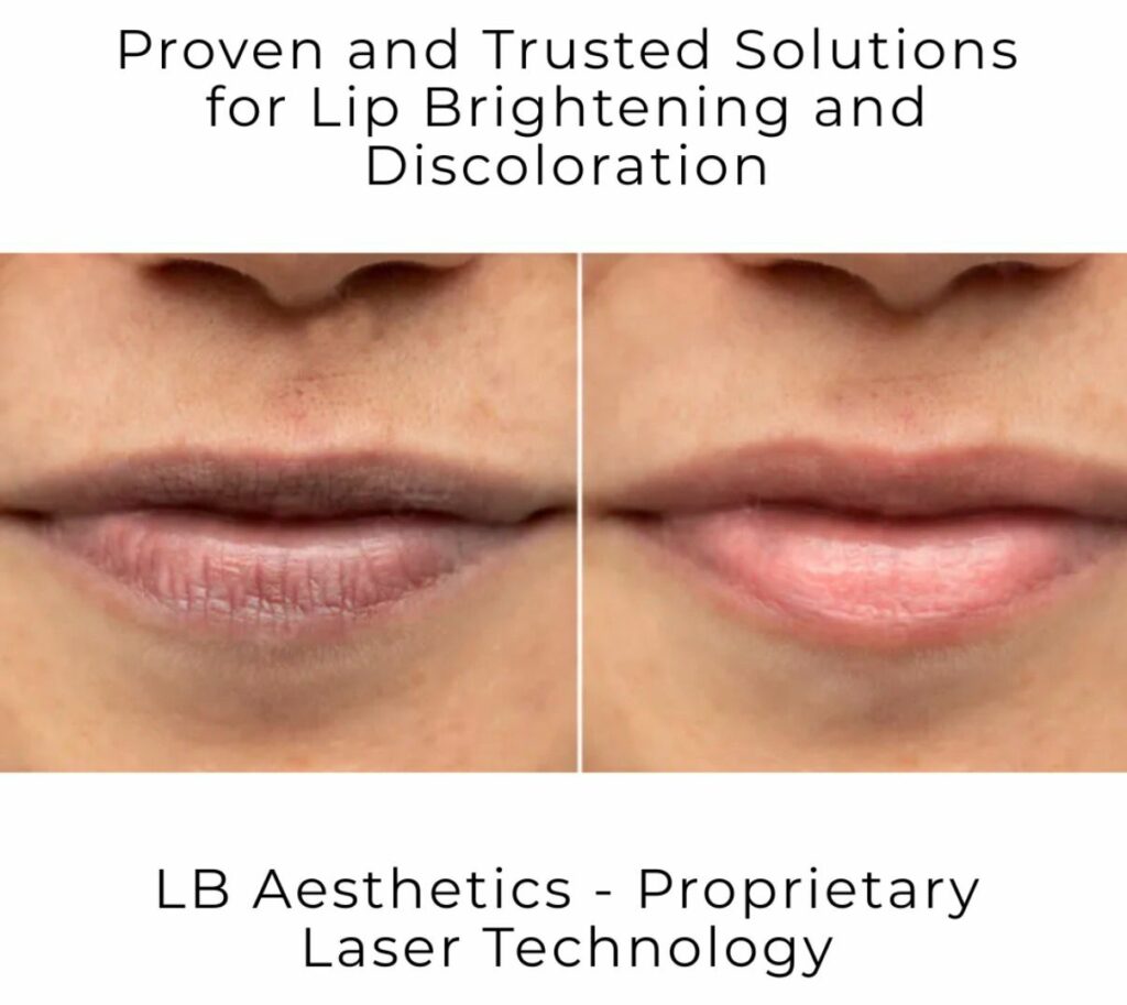 LB Aesthetics Leads the Way in Pigmentation Treatments in Delhi