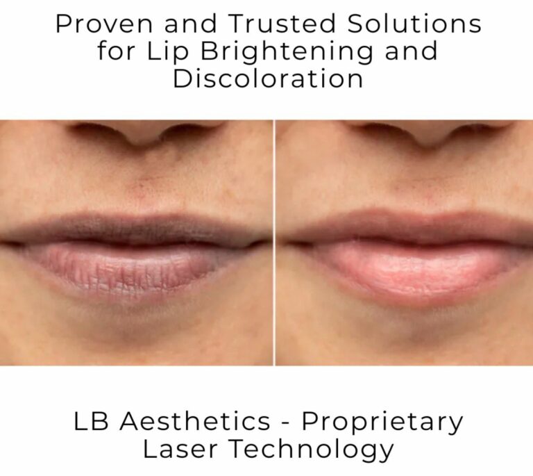 LB Aesthetics Leads the Way in Pigmentation Treatments in Delhi