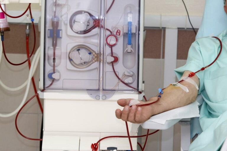 How Kidney Dialysis Is Done: Step-by-Step Overview for Beginners