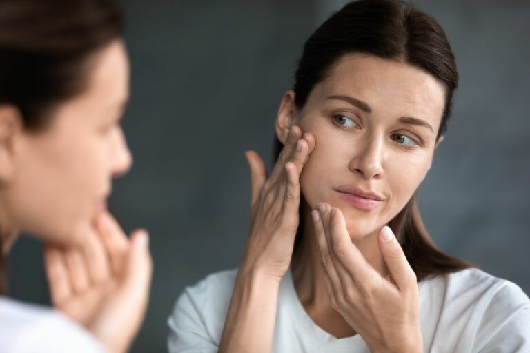 Why Traditional Acne Treatments Fail Women with PCOS