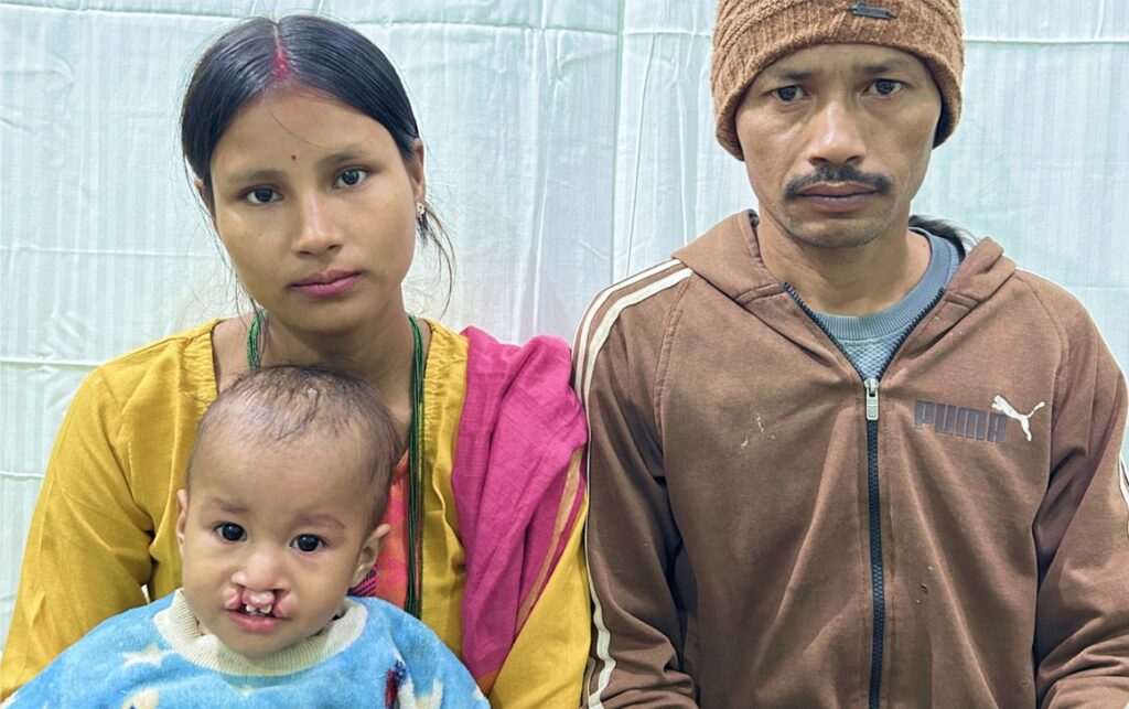 Until they are sold no more: How Love Without Reason Is Rewriting the Story of Cleft Children in India and Beyond