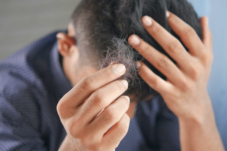 What Are the Main Causes of Hair Fall in Men?