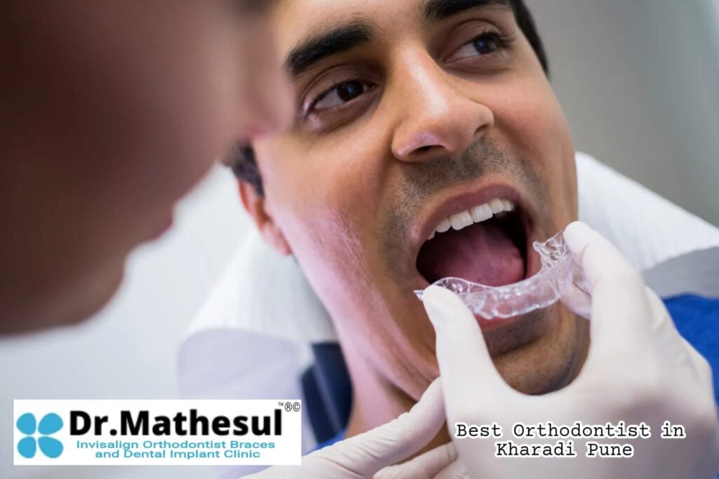 Best Orthodontist in Kharadi Pune