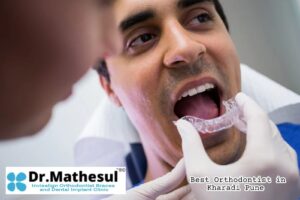 Best Orthodontist in Kharadi Pune