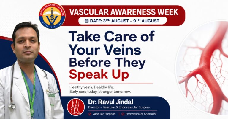 Vascular Awareness Week : Take Care of Your Veins Before They Speak Up