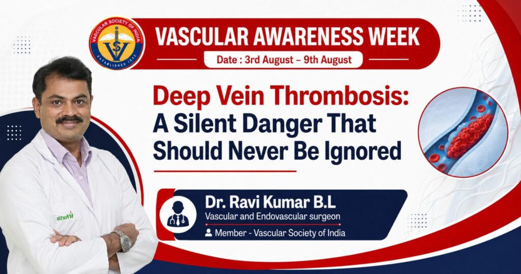 Deep Vein Thrombosis: A Silent Danger That Should Never Be Ignored