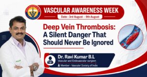 Deep Vein Thrombosis: A Silent Danger That Should Never Be Ignored