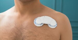 Okto Healthcare Strengthens Home-Based Cardiac Monitoring in Bengaluru with Holter ECG and 24-Hour ABPM Services