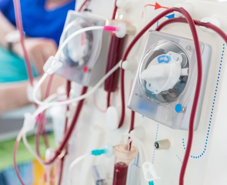 When Does Chronic Kidney Disease Require Dialysis? Signs and Treatment Options